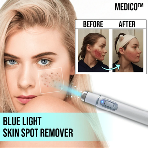 NEW BLUE LIGHT SKIN SPOTS REMOVAL PEN