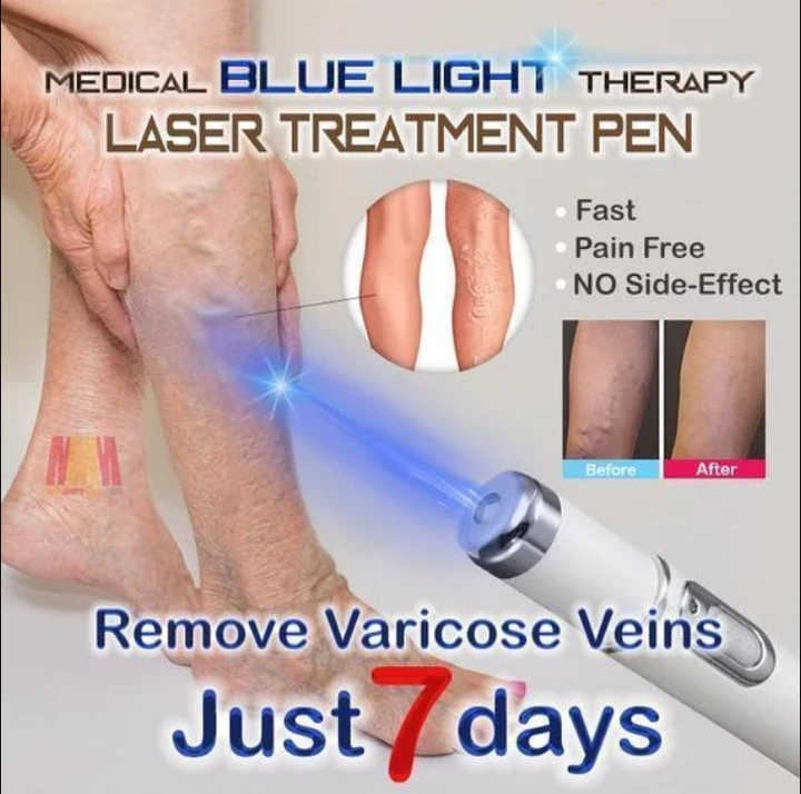 NEW BLUE LIGHT SKIN SPOTS REMOVAL PEN